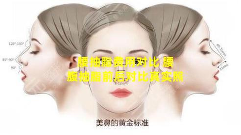 腰抽脂费用对比 腰腹抽脂前后对比真实照